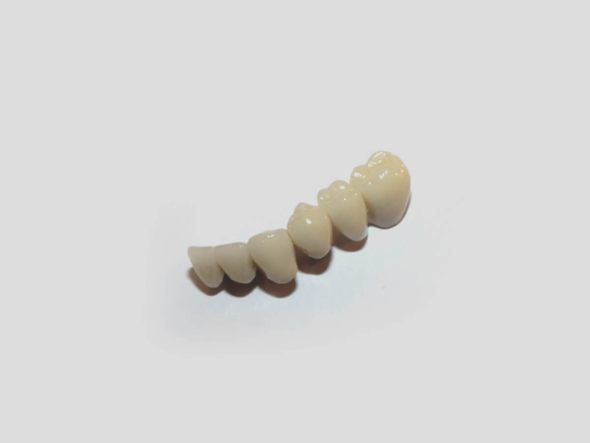 Korony cyrkonowe i porcelanowe